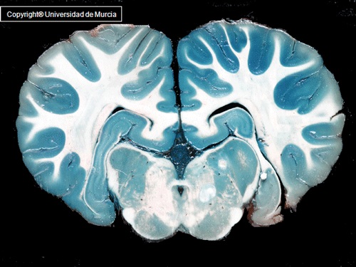 Equine Brain Dissection Anatomy Resources (I & II) - WikiVet English