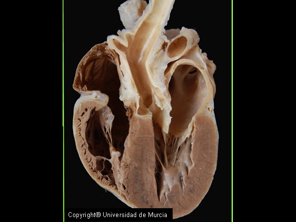 Canine heart - sectioned.jpg