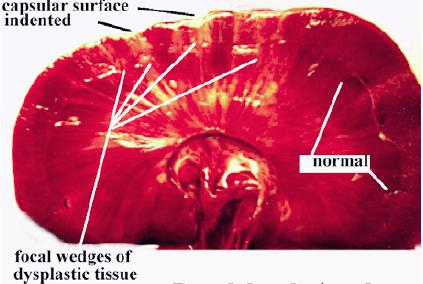 File:Renal dysplasia dog gross.jpg