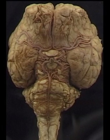 Ventral surface of the brain potcast.jpg