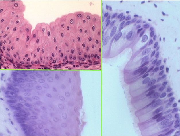 Epithelia Dragster 2.jpg