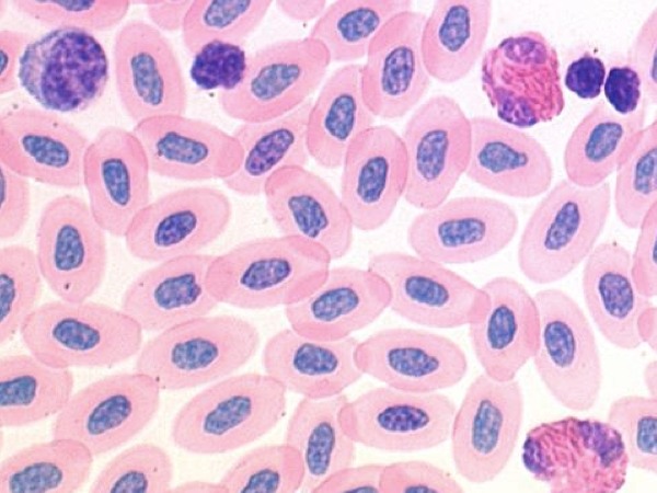 Blood Histology Dragster 3.jpg
