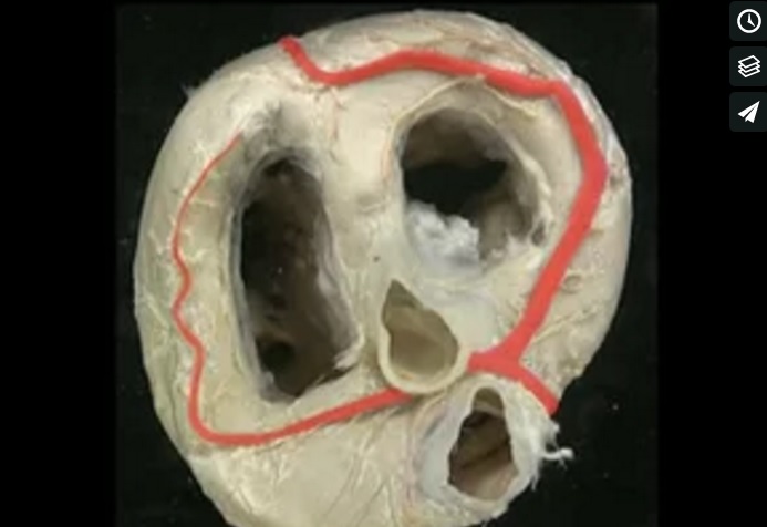 Dorsal view of the ventricles and valves of the heart.jpg