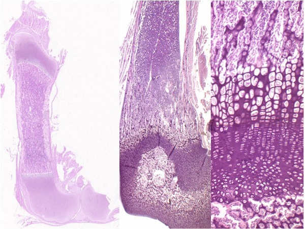 Bone and cartilate histology 2.jpg