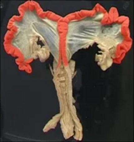 Porcine uterus potcast.jpg