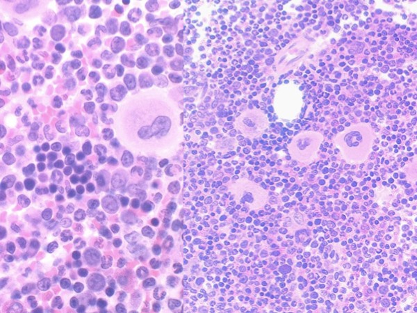 Blood Histology Dragster 4.jpg