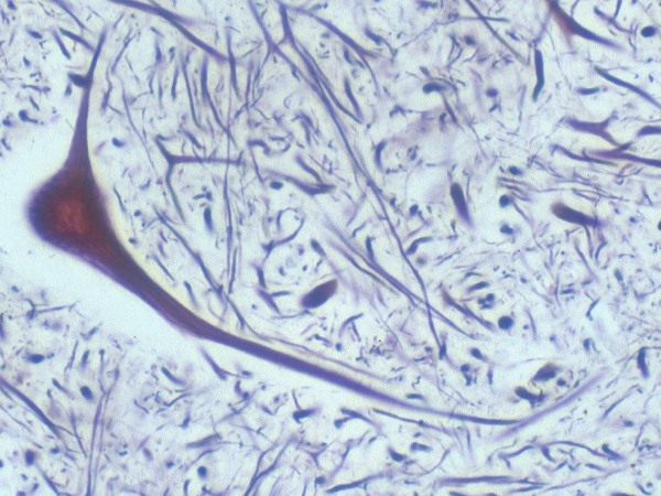 Nerve cells 2.jpg