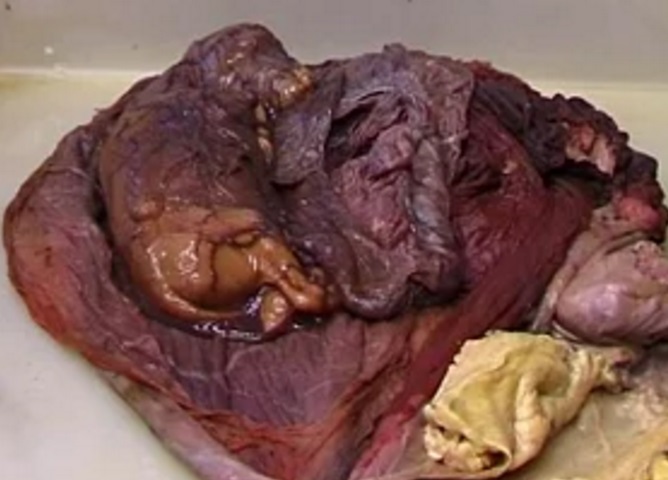 Female genital tract from a pregnant mare dissection.jpg