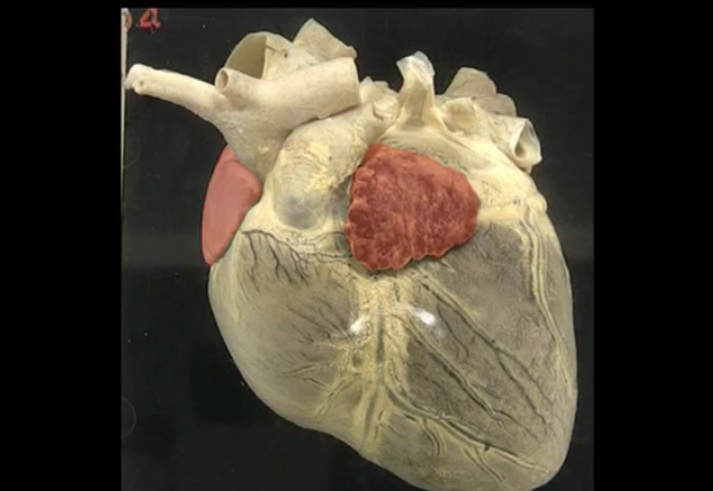 Heart potcast.jpg