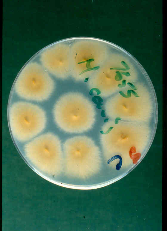 Microsporum canisCopyright Professor Andrew N. Rycroft, BSc, PHD, C. Biol.F.I.Biol., FRCPath