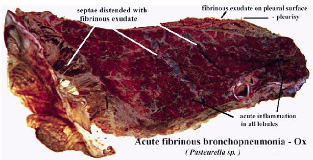 File:Acute fibrinous bronchopneumonia.jpg