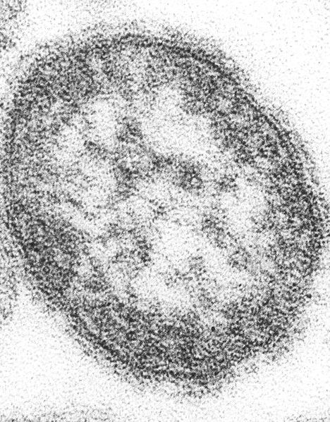 Measles logo.jpg