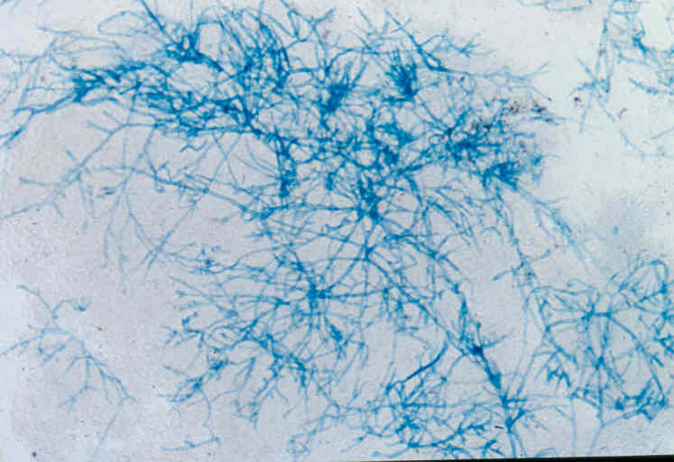 Aspergillus mycelium stained with blue/black Quink - Copyright Professor Andrew N. Rycroft, BSc, PHD, C. Biol.F.I.Biol., FRCPath
