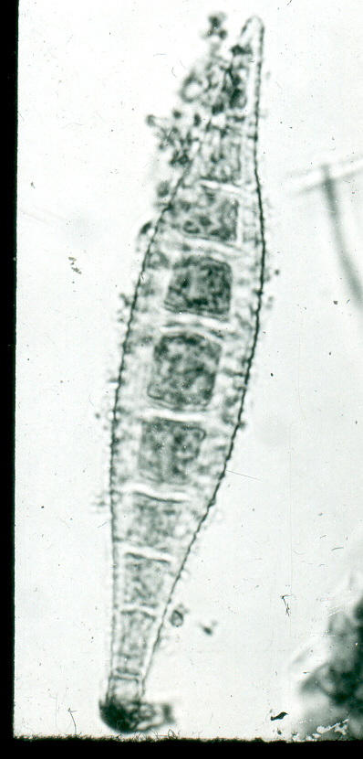 Microsporum canis macroconidiumCopyright Professor Andrew N. Rycroft, BSc, PHD, C. Biol.F.I.Biol., FRCPath