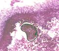 Aspergillus cleistothecia.jpg