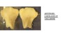 Arytenoid cartilages.jpg