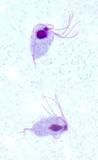 Gonorrhea | Lab Tests Online-HU, Húgycső kenetje a Trichomonasra