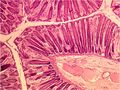 Mucosal layer of colon.jpg