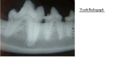 Tooth Radiograph.jpg