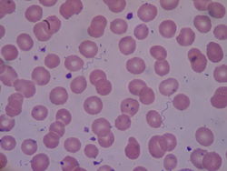 spirochetes gram stain