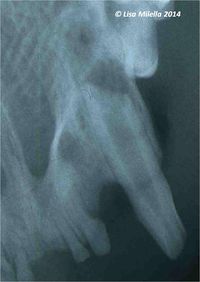 Endodontic disease radiograph 3.jpg