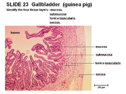 gallbladder histology labeled