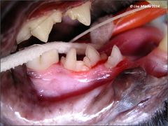 Supernumerary teeth 2.jpg