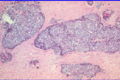 Thumbnail for version as of 11:09, 10 August 2007