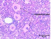 megakaryocyte histology