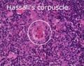 LH Hassalls Corpuscle Histology.jpg