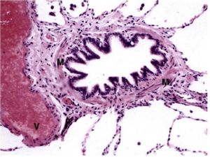 bronchus vs bronchiole histology