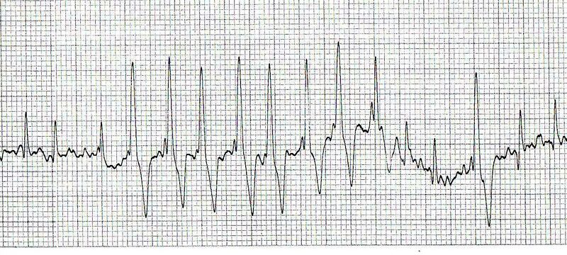 File:Clinical Case 5 03.jpg