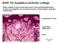 Epiglottis histology 2.jpg