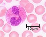 Eosinophils