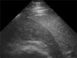 LH Spleen Equine Ultrasound.jpg