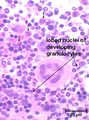 LH Bone Marrow Granulocyte Histology.jpg