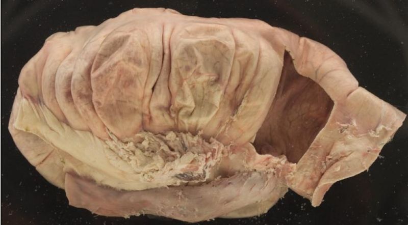 File:Ileocoeliac junction pig.JPG