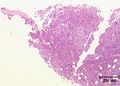 LH Bone Marrow 1 Histology.jpg