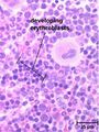 LH Bone Marrow Erythroblasts Histology.jpg